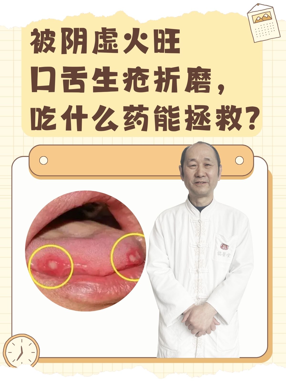 【中兴千舒是什么药,中兴细胞高说明什么】